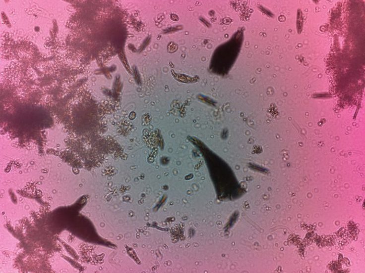 plankton-under-IBM-3D-microscope-768x576